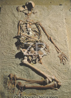 5301. Skeleton of a monk